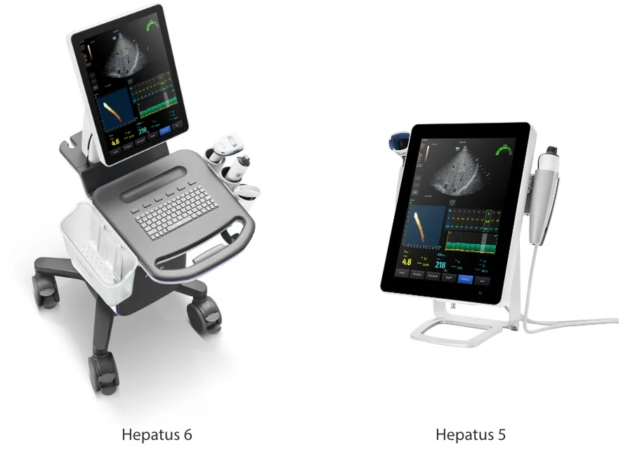 Hepatus Fibroscan Machine Supplier in Lucknow - Indionix Healthcare